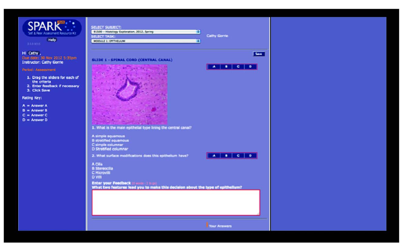 Screen shot of Histology slide in SparkPlus