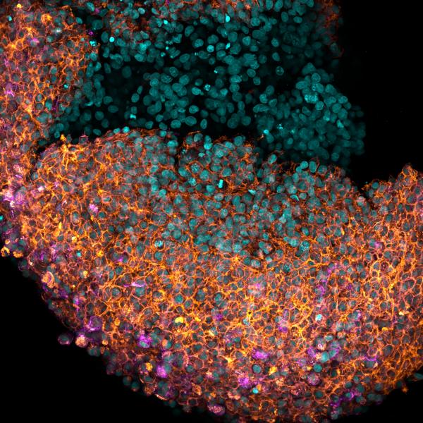 Image of a 3d printed organoid