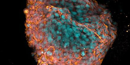 Image of an placenta organoid