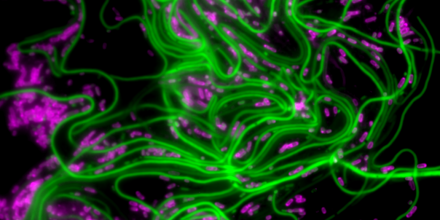 Imaging of UTI bacteria trails