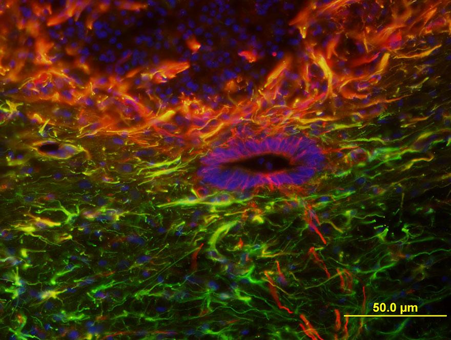 Microscopic view of spinal cord