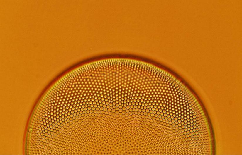 Coscinodiscus