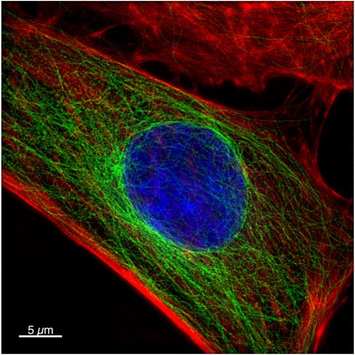 Cell under microscope