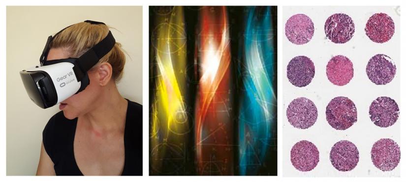 Left: Predicting treatment outcomes for childhood cancers with the Children's Hospital at Westmead. Using a virtual reality platform, clinicians compare the human genome and treatment outcomes of people affected by cancer to provide personalised treatment plans. Image: Silver Orchid / Pixabay Centre: The bondi language implements pattern matching using pattern calculus. Right: Data from thousands of tumour specimens is used by the Lab's software to compare gene expressions and biological variants in patient