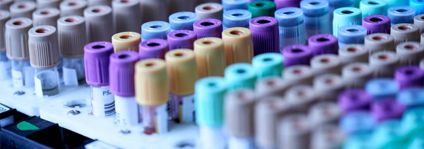 rows of blood vials in a lab