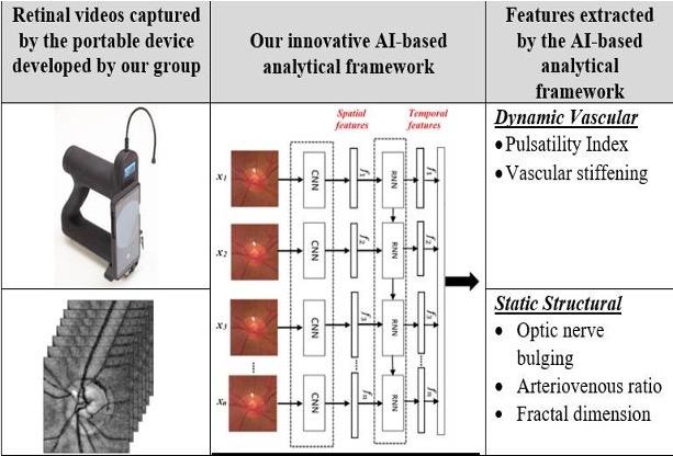 An overview of UTS’ invented all-in-one solution. A ten second video is recorded from the back of the eye using the smartphone integrated portable device before passing onto an AI-based framework. 