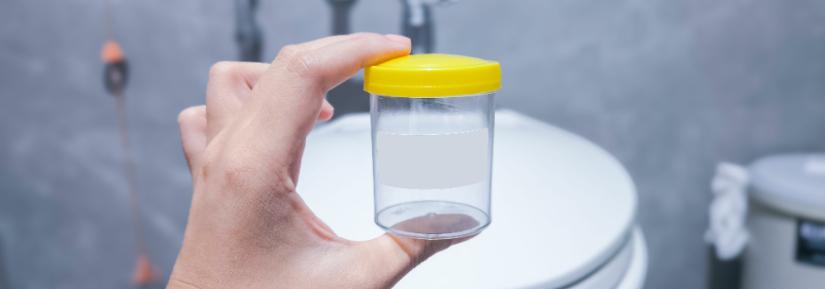 Urine test jar. 