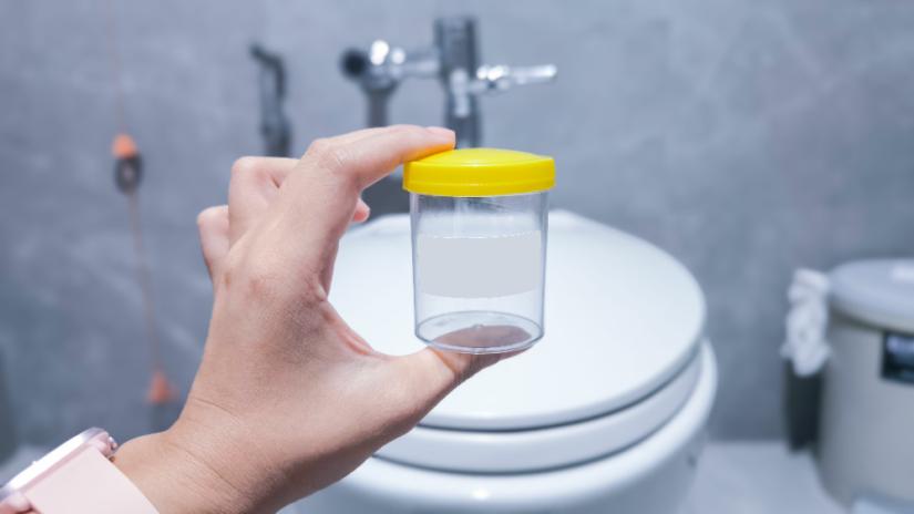 Urine test jar.