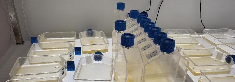 Variety of microalgal cultures being grown