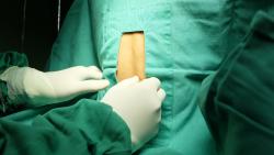 Doctor's gloved hands preparing patient for spinal anaesthesia