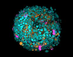 Image of an organoid