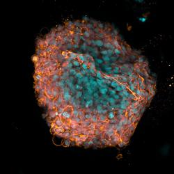 Organoid image