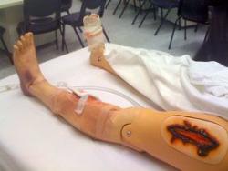 Photo of manikin leg demonstrating trauma
