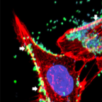 Epithelial Cells