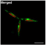 Extracellular Actin