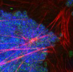 Extracellular Actin Front